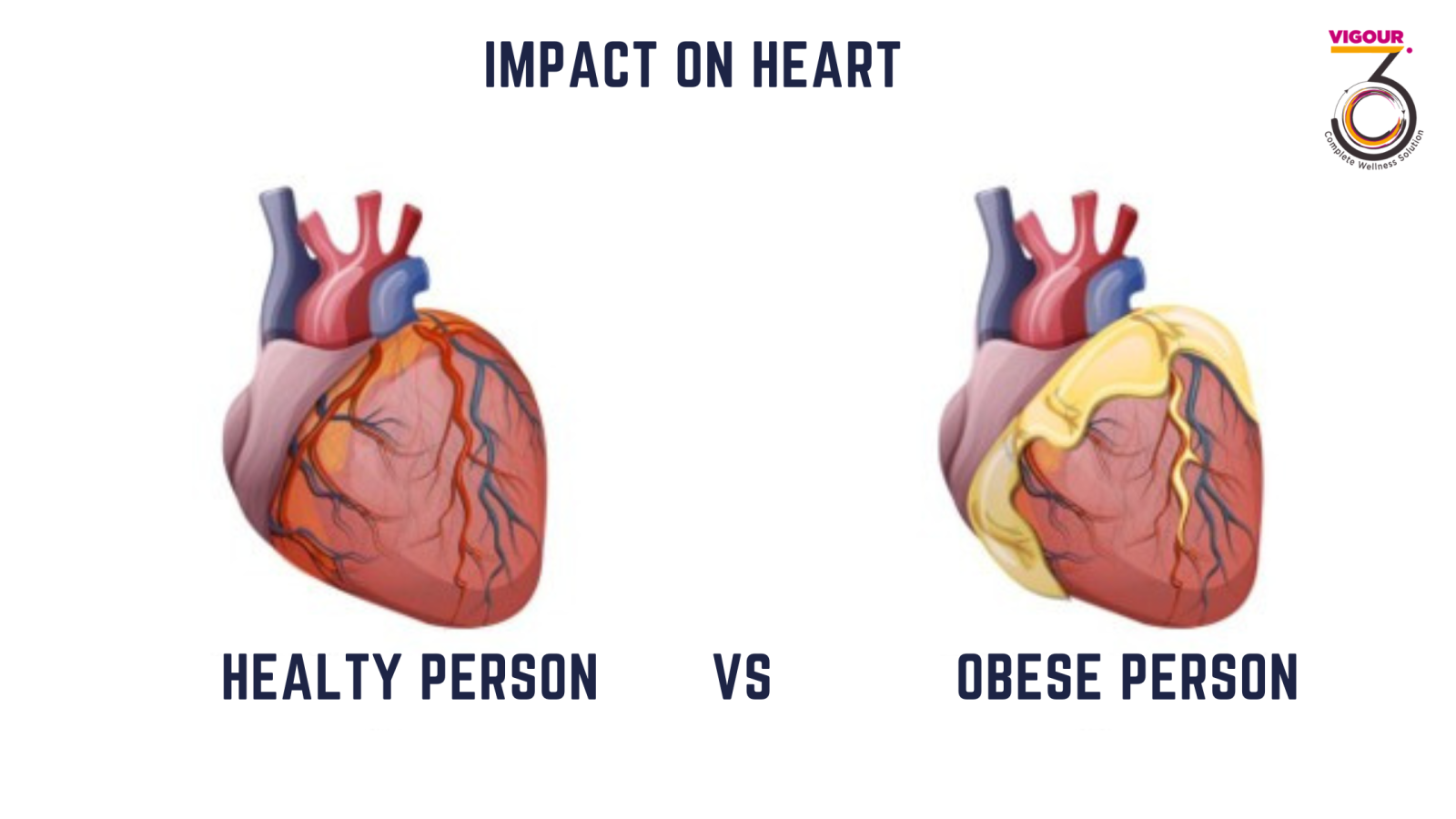 Healthy vs Obese heart