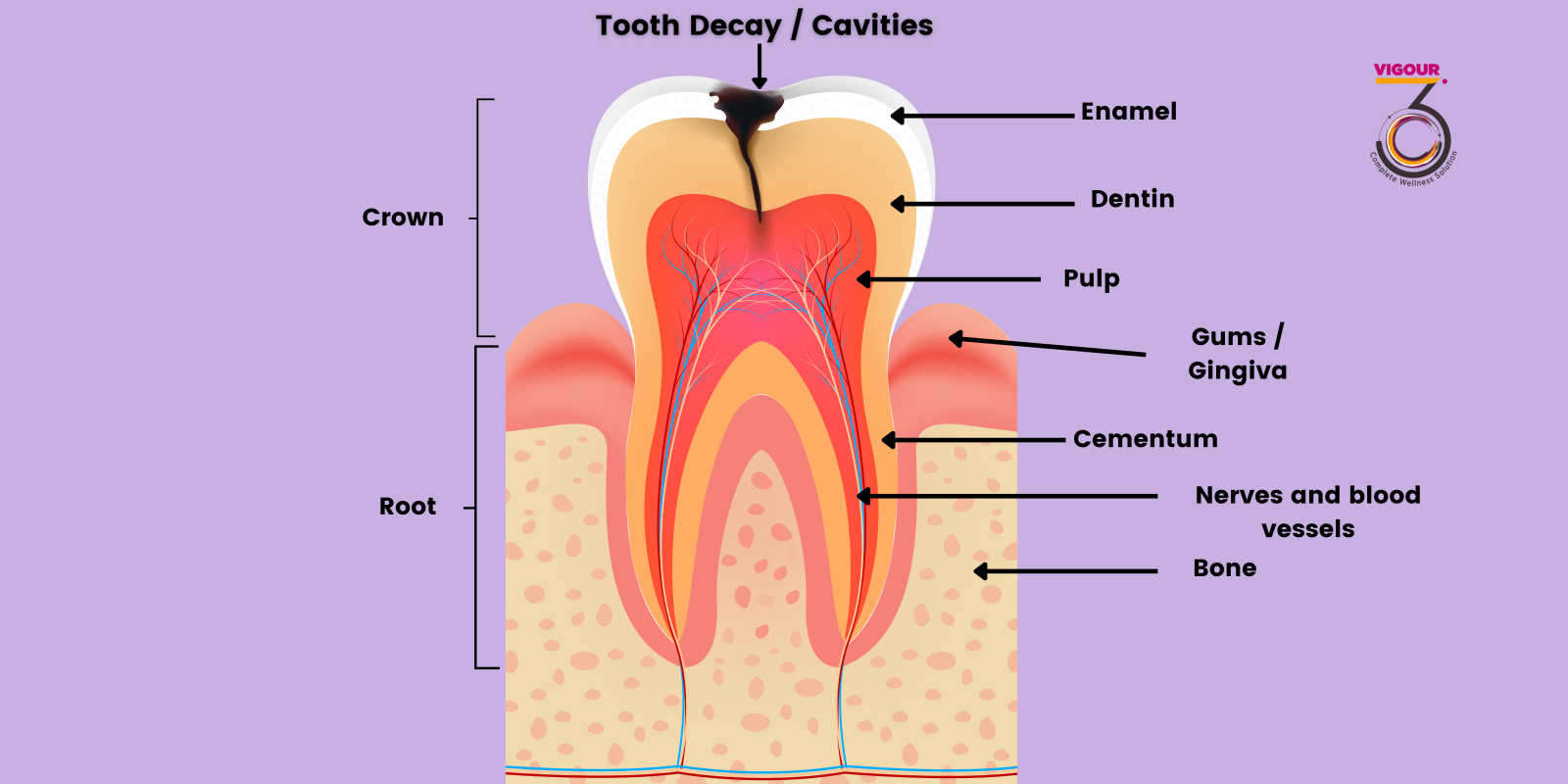 Tooth structure